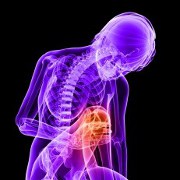 Arthritis related image